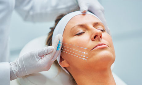 Dra Debora Reis – Harmonização Facial Procedimento de harmonização facial com fios de sustentação realizado por profissional especializado, promovendo efeito lifting com naturalidade.
