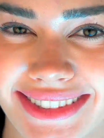 Novo sorriso de Franciny Ehlke, com lentes de pocelana feitas pela Dra. Débora Reis