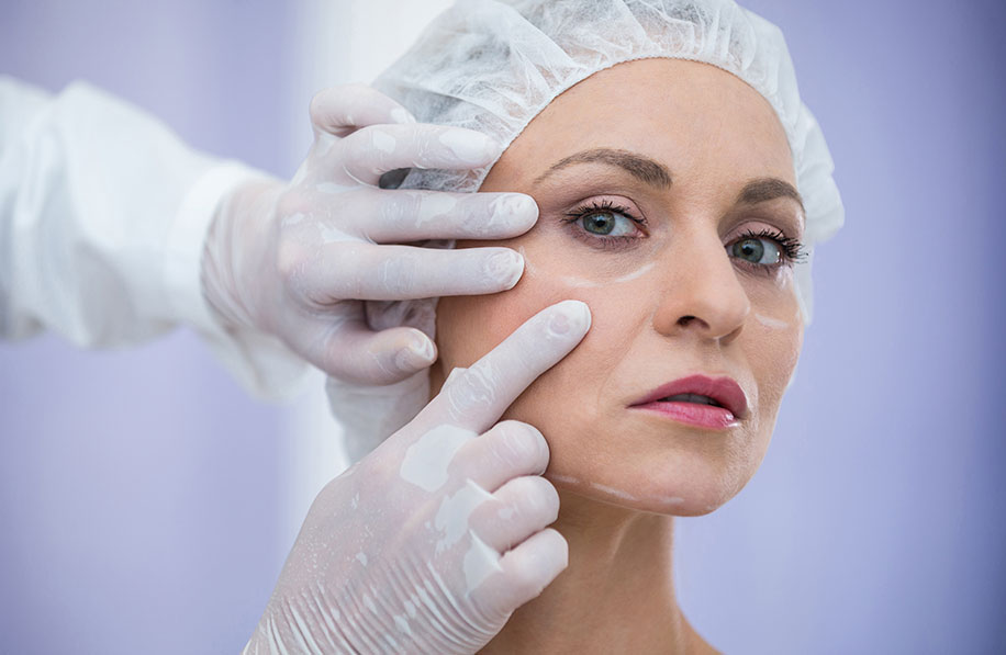 Avaliação clínica do rosto feminino com marcações para procedimento de bichectomia