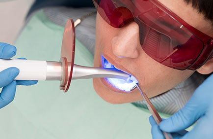 Dra Debora Reis – Laserterapia Procedimento de laserterapia realizado por dentista com equipamentos de precisão