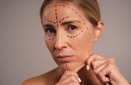 Dra Debora Reis – Preenchimento Facial Mulher com linhas marcadas no rosto demonstrando regiões com flacidez antes do preenchimento facial