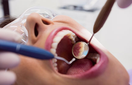 Close em boca aberta com instrumentos odontológicos durante avaliação pré-remoção de siso