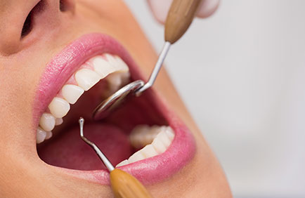Dra Debora Reis – Restauração Dentária Close em dentes sendo avaliados com explorador e espelho durante procedimento de restauração dental