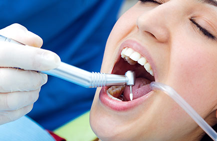 Dra Debora Reis – Restauração Dentária Dentista realizando restauração dentária com instrumento rotatório em paciente jovem