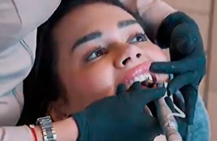 Dra, Débora Reis – Franciny Ehlke Lentes de contato dental - Franciny Ehlke